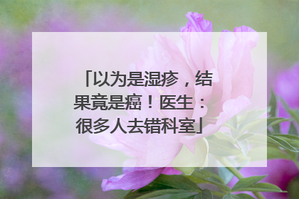 以为是湿疹，结果竟是癌！医生：很多人去错科室